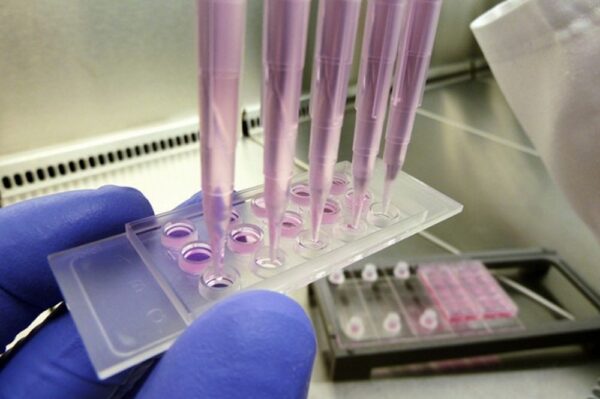 Image_Product_Ibidi_81506_1000x665_JPG_02 Image_Product_Ibidi_81506_1000x665_JPG_02