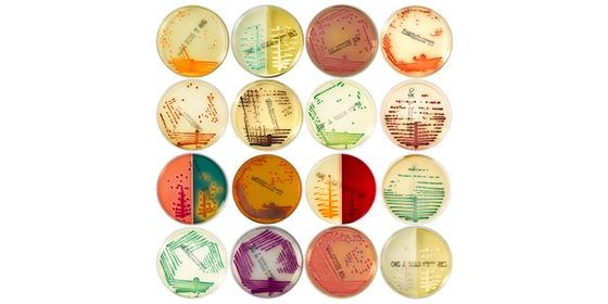 BioMérieux SA - Microbiology - Chromogenic culture media